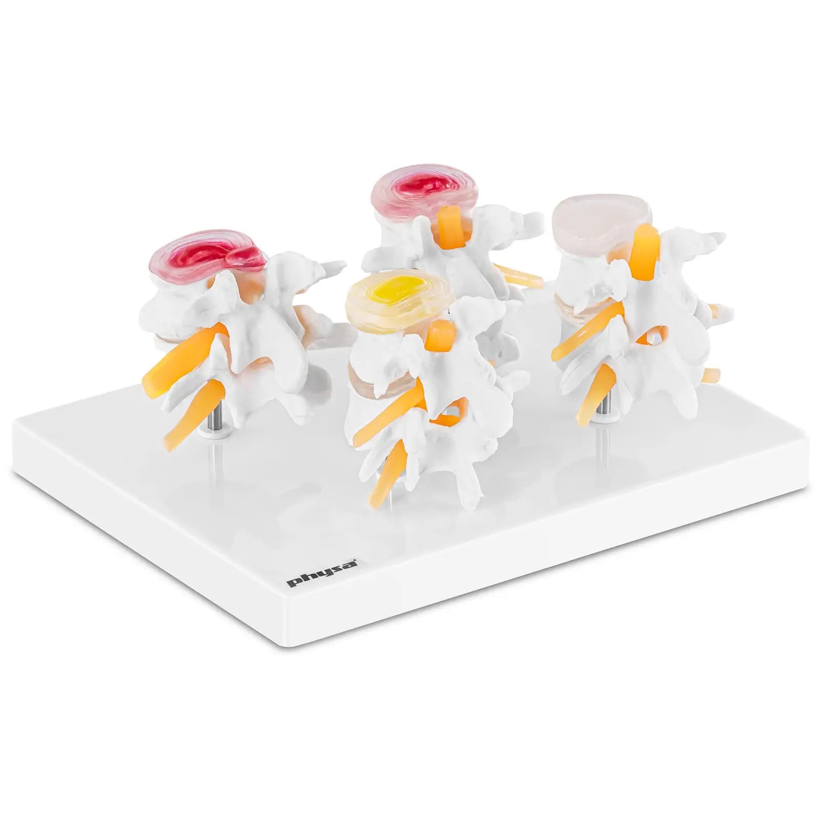 physa B-Ware Lendenwirbel Modell - in 4 Teile zerlegbar - Originalgröße