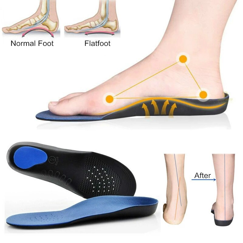 Orthopädische Einlegesohlen Orthesen Flache Füße Gesundheit Sohle Pad Für Schuhe Einsatz Bogen Unterstützung Pad Für plantarfasziitis Füße Pflege Einlegesohlen