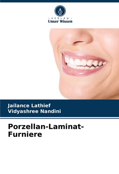 Porzellan-Laminat-Furniere