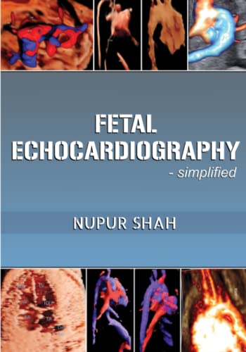 Fetal Echocardiography - Simplified