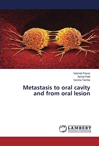 Metastasis to oral cavity and from oral lesion