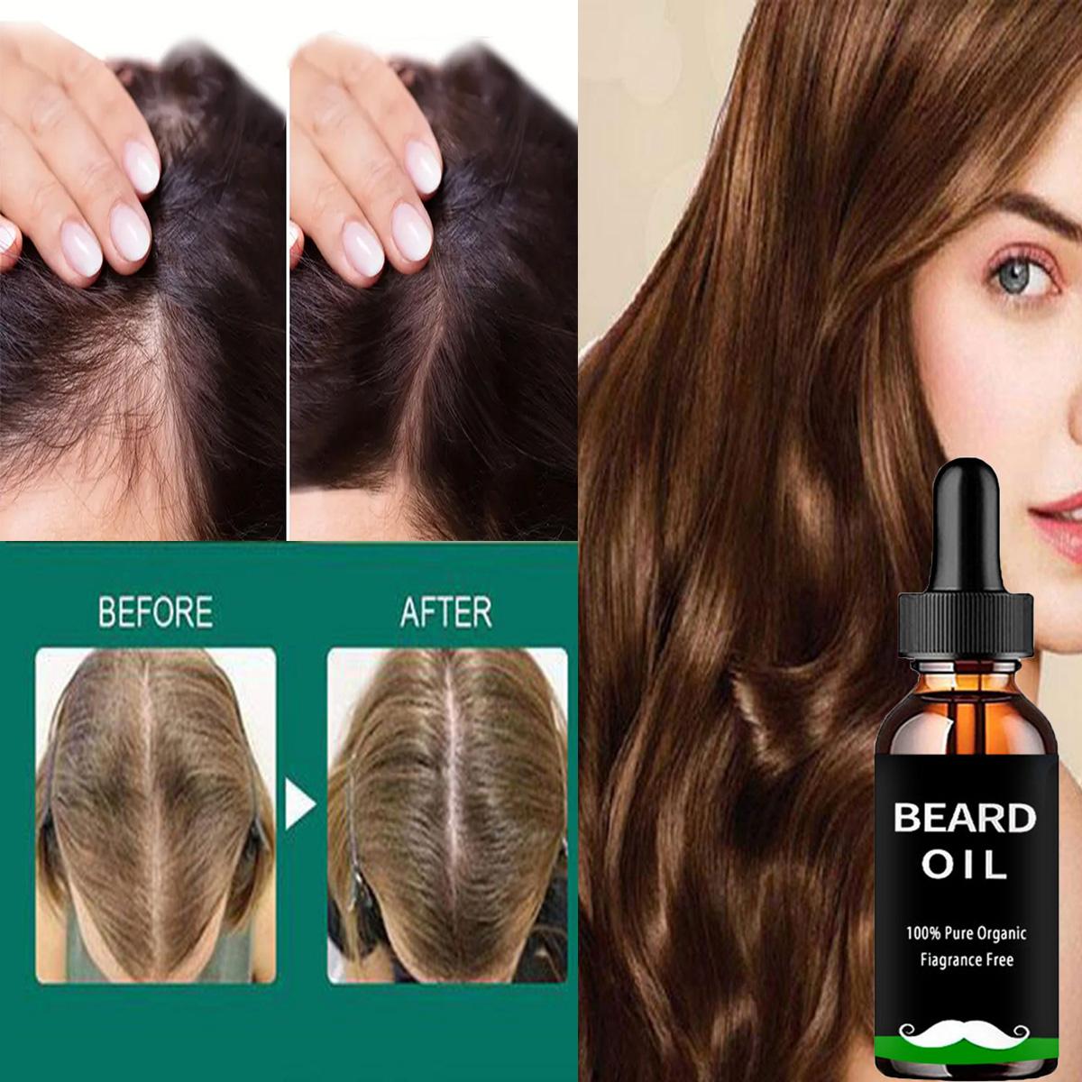 Schnelles Haarwachstum, ätherisches Öl, Schönheit, Haarpflege, verhindert Haarausfall, kontrolliert Öl, aktiviert die Haarfollikel-Behandlung 5ml