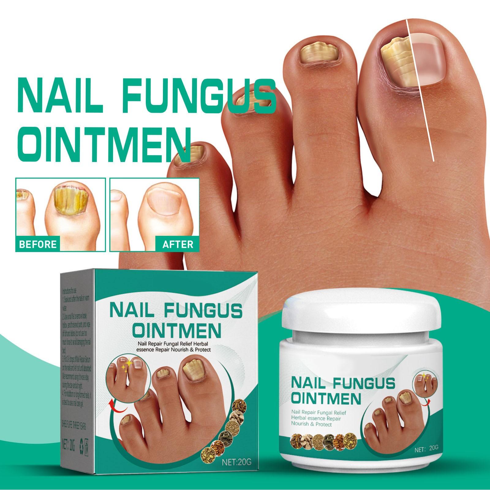 Graue Nagelpaste, verdickter, glänzender Nagel, Reparatur grauer Nägel, saubere und weiche Nagelpaste, Pflege bei kariesartigen Händen, Füßen und Zehennägeln One Size grün