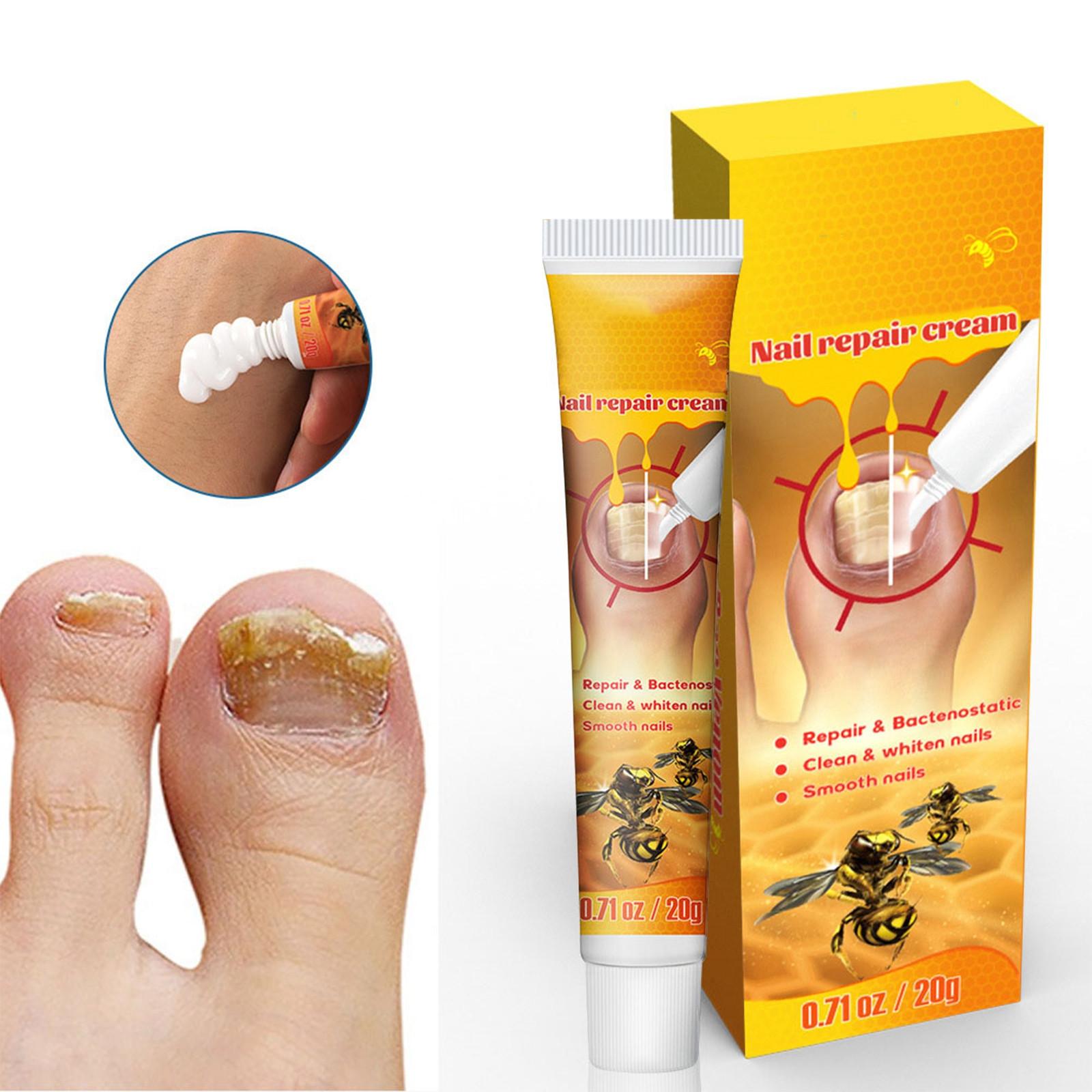 Nagelcreme, reinigt und glättet die Nägel, repariert beschädigte Nägel, stärkt die Nägel, fördert die Nagelgesundheit, nährt und befeuchtet die Haut gelb