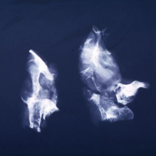 Afterpay [Explicit]