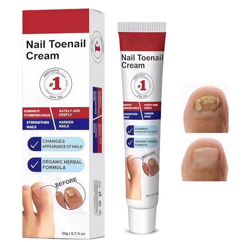 20g Nagelpflege Creme, Sanfte Nagelpflege, Nagelreparaturcreme, Stärkt und Repariert Beschädigte,Brüchige Nägel, Spaltnagelreparatur, Repariert Erscheinungsbild Verfärbter Nägel
