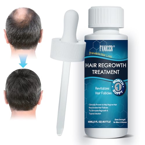 60ML Haarwachstum Serum, Hair Growth Serum bei Haarausfall, Kopfhaut Nährt, Geschenke für Männer und Vater, Kopfhaut Pflege Fördert Dickeres Haar,