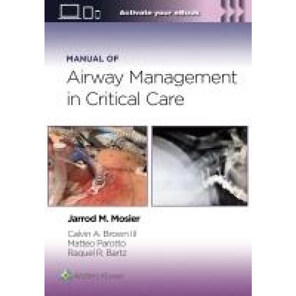 Brown, Calvin A: Manual of Airway Management in Critical Care: Print + eBook with Multimedia